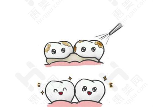 吸附性义齿的优点