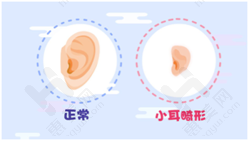 耳再造医生手术实力对比