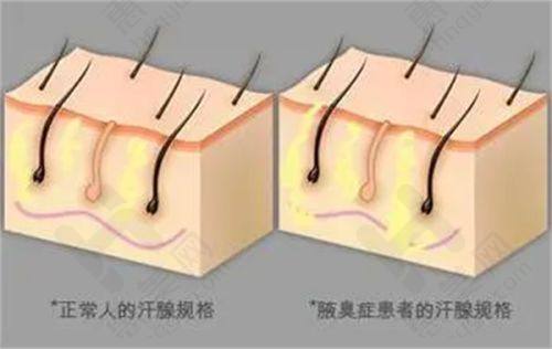 合肥韩美整形医院口碑