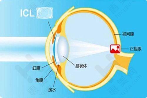 上海和平眼科翟爱琴医生预约：多种方式可选