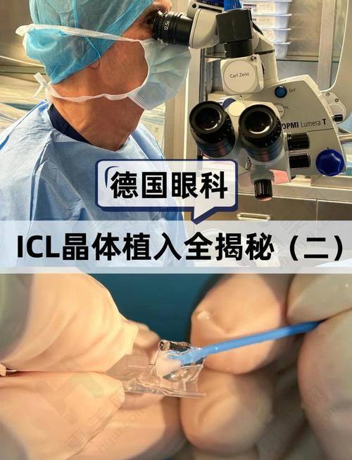 上海新视界于妍娉医生预约：便捷途径助你就诊