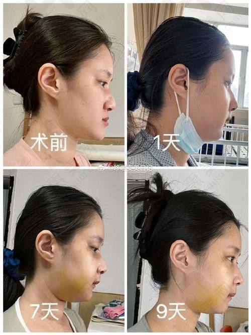 上海鼻修复骨干医生实力