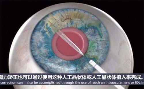 北京民众眼科医院齐越医生的出诊时间安排