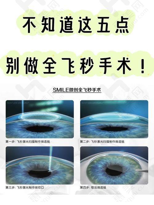 北京爱尔眼科医院口碑评价怎么样