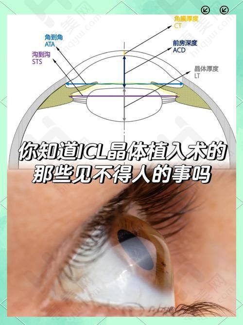 北京华德眼科医院口碑评价怎么样再次探讨