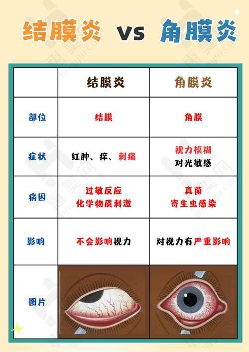 北京普祥医院封康主 任后巩膜加固术（单片）的优势有哪些