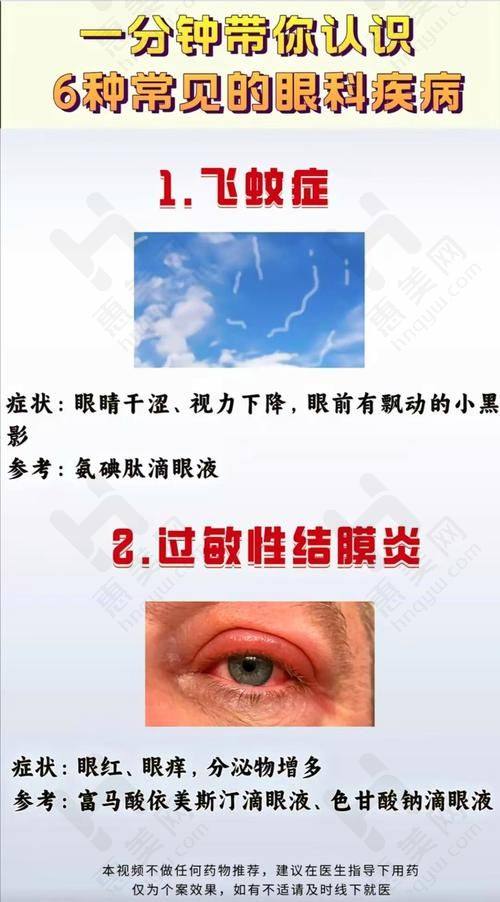 北京普祥医院封康主 任后巩膜加固术（单片）的成效如何