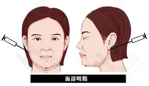 北京嘉禾医疗美容医院擅长项目​
