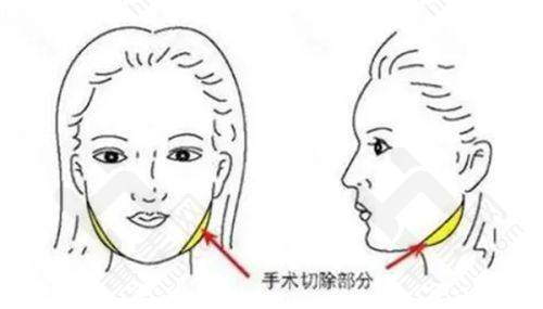 北京嘉禾医疗美容医院地址及乘车路线​