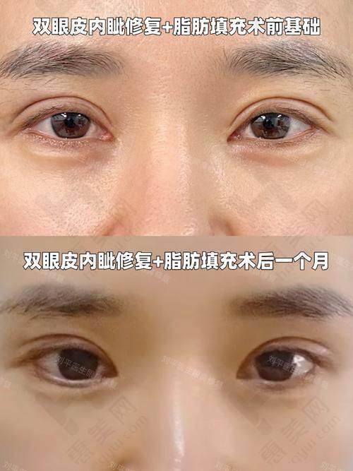 莆田颧骨颧弓医院排名里哪家医院口碑更好
