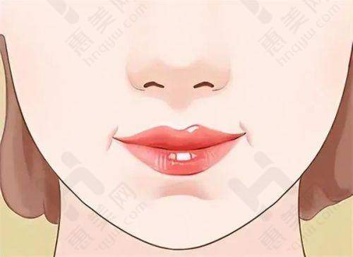 选择激光祛眼袋的注意事项