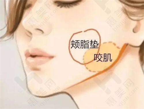 激光祛眼袋与其他祛眼袋方式的价格对比