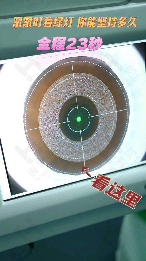 汕尾爱尔眼科收费情况