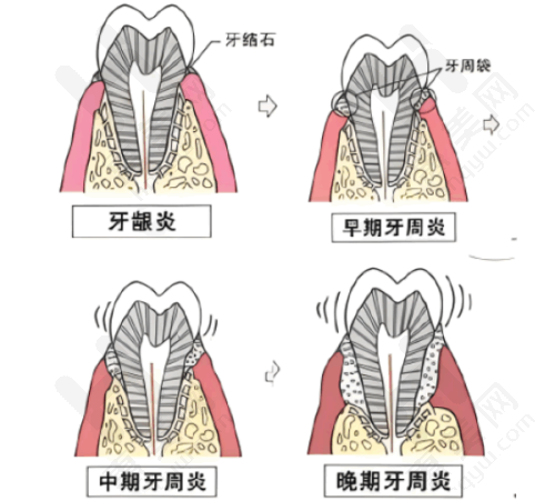 总结