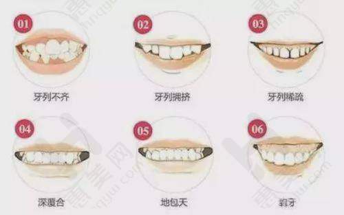 总结