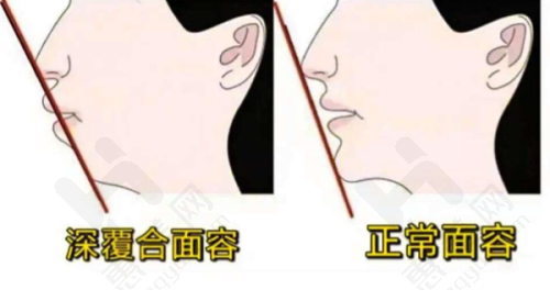 (四)补牙价格
