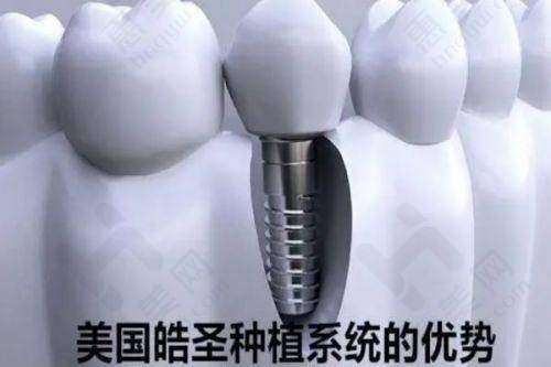 特色项目