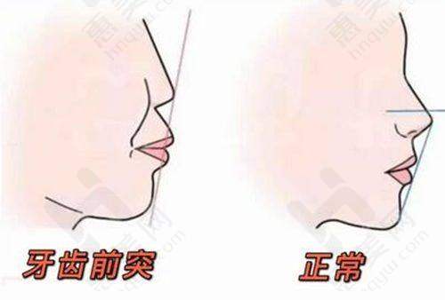 综合评价