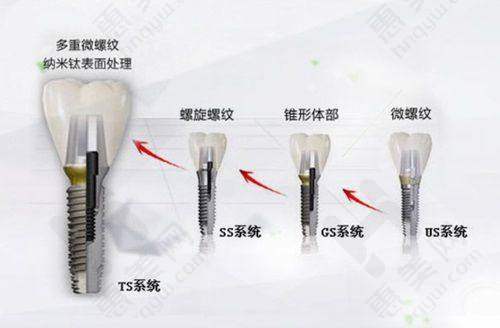 总结