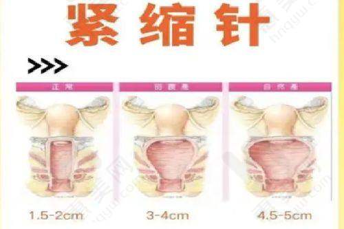 青岛熙朵医疗美容诊所2025年价格表