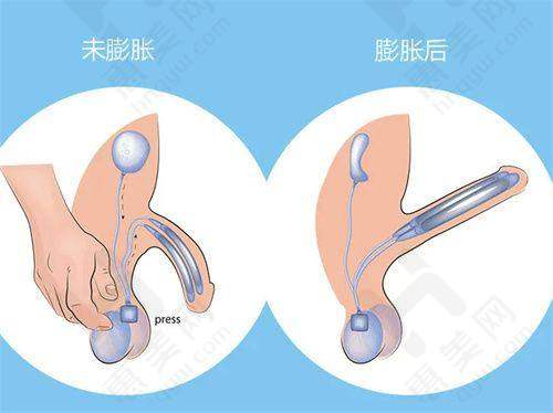 价格参考