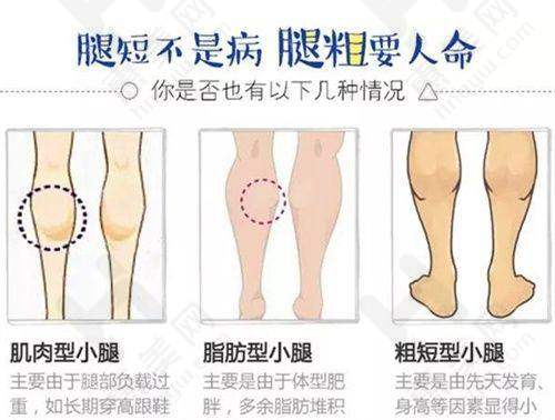 求美者选择建议