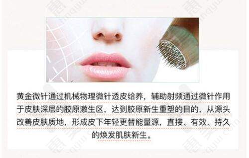 定制方案特色