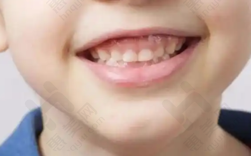 福鼎优贝口腔田波医生