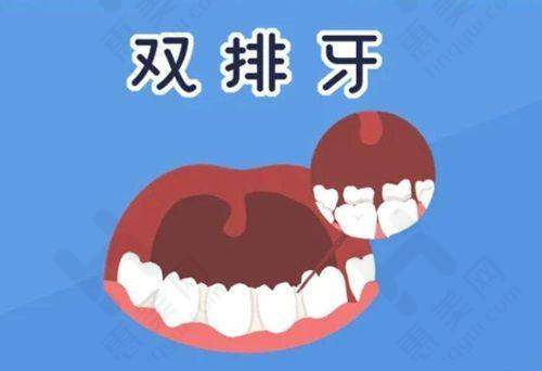 总结