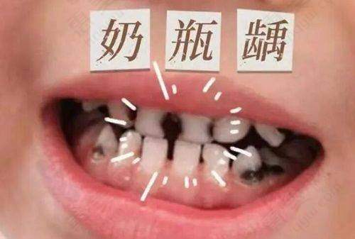 温州蓝芽口腔门诊部
