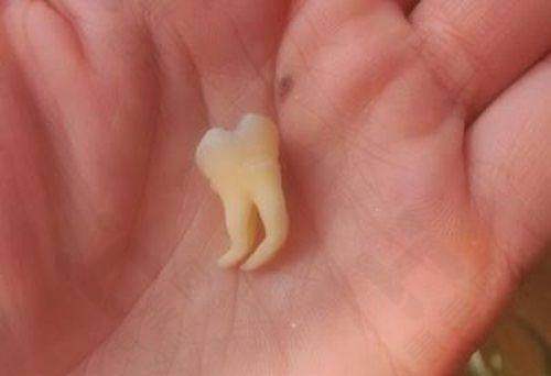 凸嘴矫正项目的价值