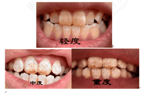 总结