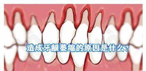 总结