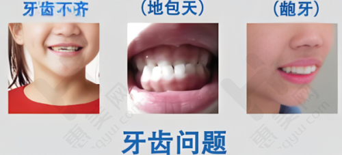 总结