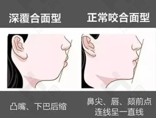总结
