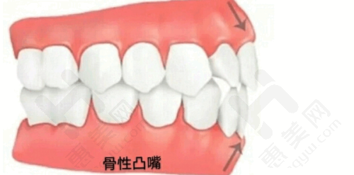 优惠活动