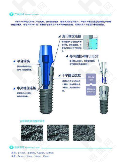 医院特色技术