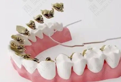 特色项目之牙齿治疗