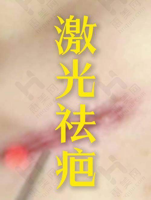 贵阳华医医院疤痕专科技术与设备