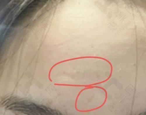 贵阳华医医院疤痕专科医生团队