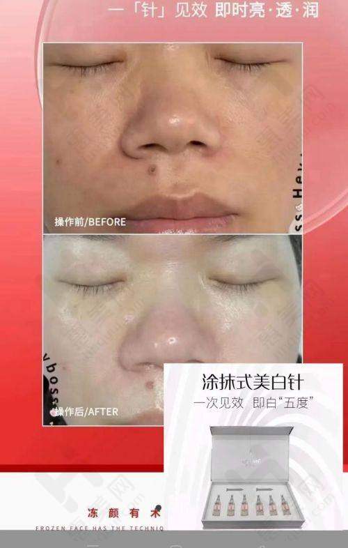 消除馒化：医生实例对比