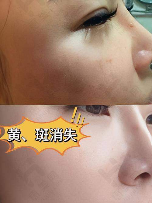 不同次数：修复情况实测