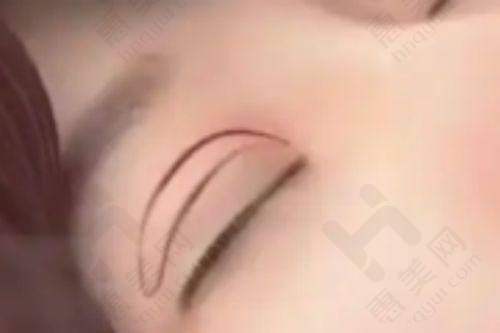 哈尔滨医 科 大学附属二院皮肤科优势