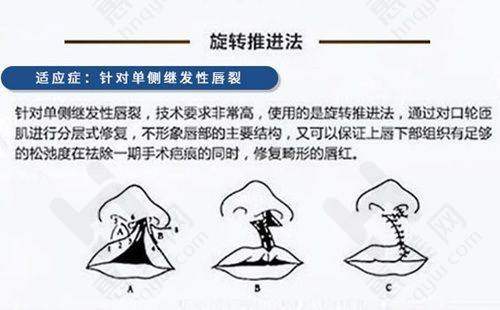 部分医院骨干医生推荐:专精助力皮肤健康