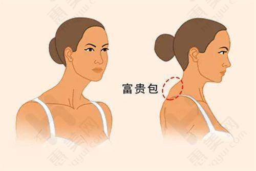 在线免费询问:便捷就医新选择