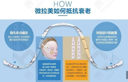 宜兴市人民医院皮肤科依托优势发展