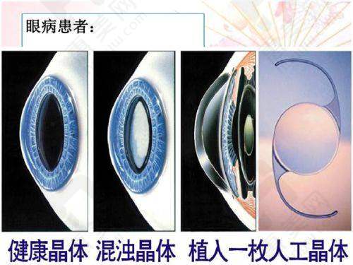 无锡市人民医院皮肤科优势明显