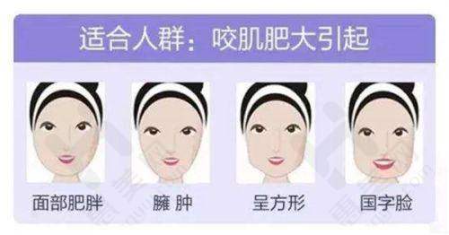 广东广州美莱医美医院技术