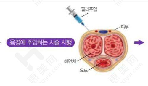 河北省中医院整形美容科特色项目及优势