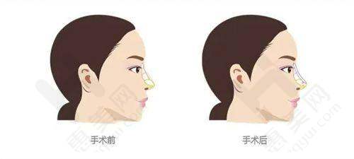 整形项目价格参考（以温州部分机构为例）